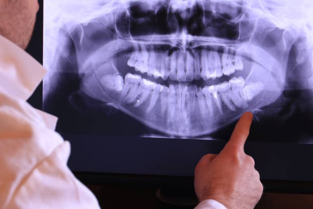 Best Emergency Denture Repair in Miles City, MT