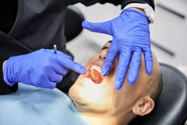 Best Emergency Dental Care for Broken or Chipped Teeth in Miles City, MT
